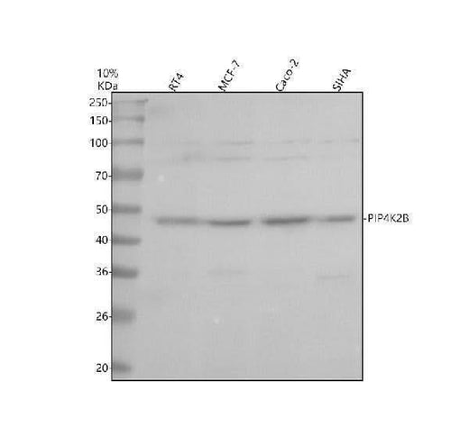 Anti-PIP4K2C Antibody Picoband® Boster Bio