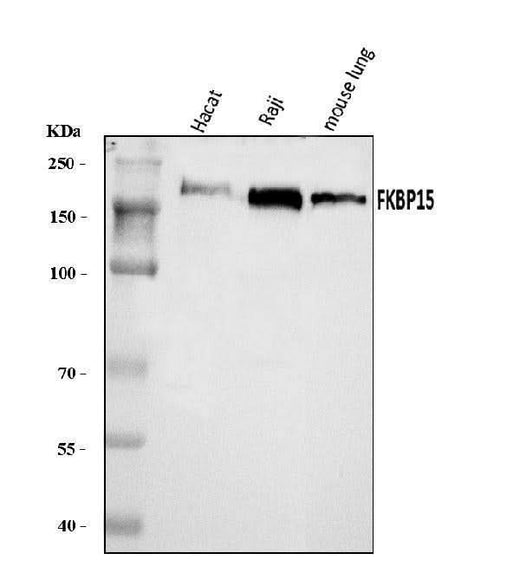 Anti-FKBP135/FKBP15 Antibody Picoband® Boster Bio