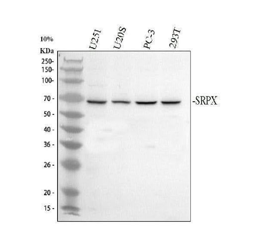 Anti-SRPX Antibody Picoband® Boster Bio