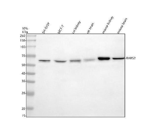 Anti-RARS2 Antibody Picoband® Boster Bio