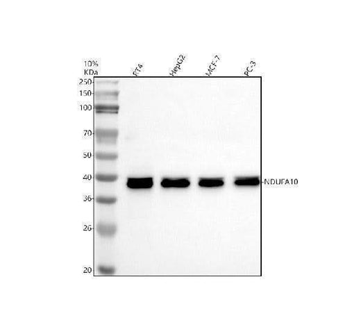 Anti-NDUFA10 Antibody Picoband® Boster Bio