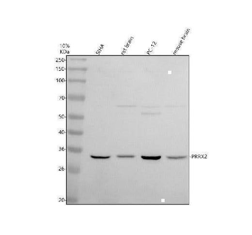 Anti-PRRX2 Antibody Picoband® Boster Bio