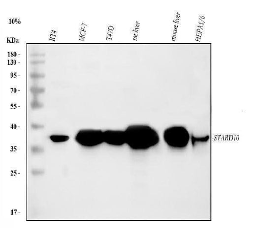 Anti-PCTP-L/STARD10 Antibody Picoband® Boster Bio