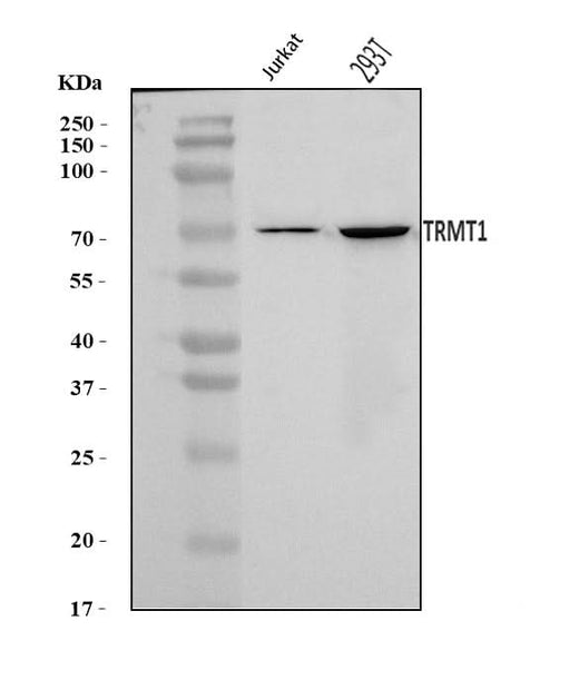 Anti-TRMT1 Antibody Picoband® Boster Bio