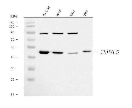 Anti-TSPYL5 Antibody Picoband® Boster Bio