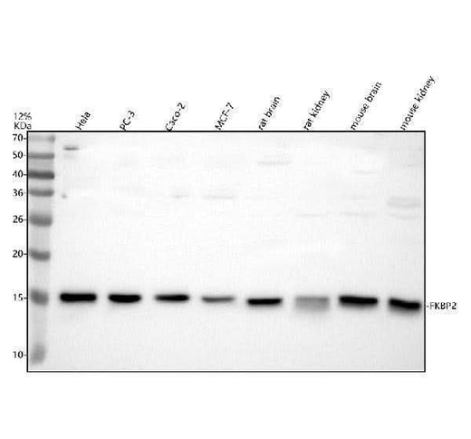 Anti-FKBP2 Antibody Picoband® Boster Bio