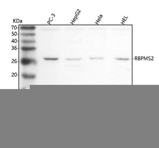 Anti-RBPMS2 Antibody Picoband® Boster Bio