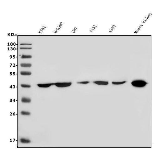 Anti-HOXD11 Antibody Picoband® Boster Bio