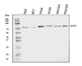 Anti-Solo/SESTD1 Antibody Picoband® Boster Bio