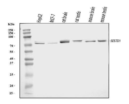 Anti-Solo/SESTD1 Antibody Picoband® Boster Bio