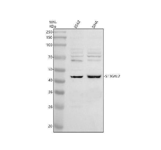 Anti-ST3GAL2 Antibody Picoband® Boster Bio