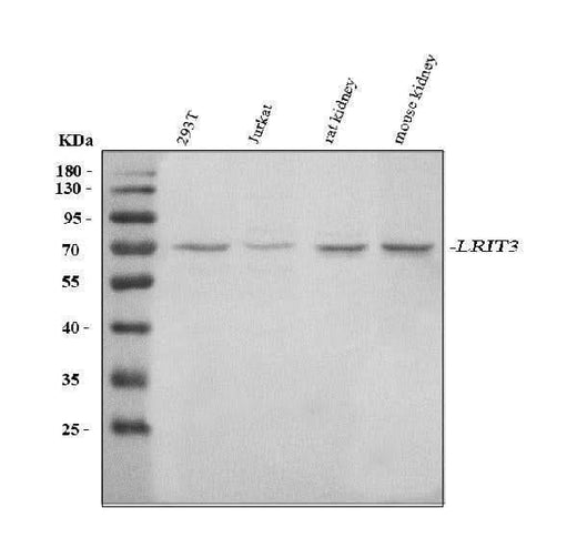 Anti-LRIT3 Antibody Picoband® Boster Bio