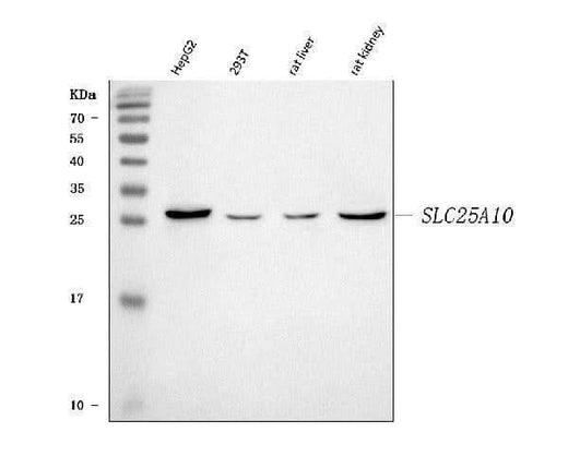Anti-Mitochondrial dicarboxylate carrier/SLC25A10 Antibody Picoband® Boster Bio