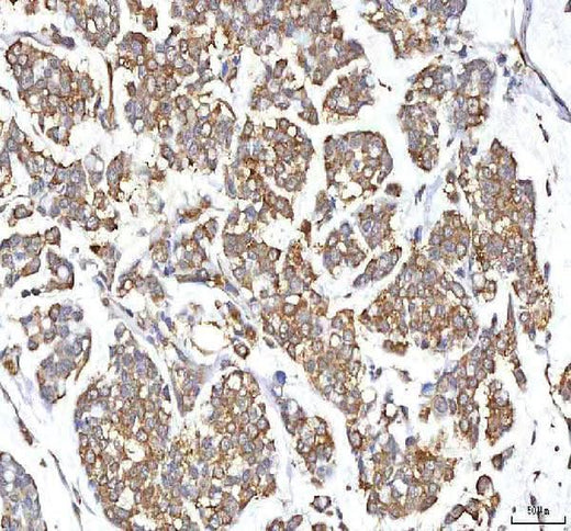 Anti-GOLGA7 Antibody Boster Bio