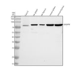 Anti-GALNT6 Antibody Picoband® Boster Bio