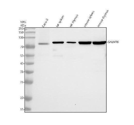 Anti-GALNT6 Antibody Picoband® Boster Bio