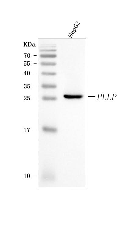 Anti-Plasmolipin/PLLP Antibody Picoband® Boster Bio