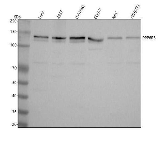 Anti-SAPS3/PPP6R3 Antibody Picoband® Boster Bio