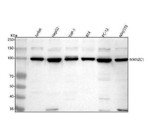 Anti-MAN2C1 Antibody Picoband® Boster Bio