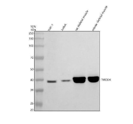 Anti-TMOD4 Antibody Picoband® Boster Bio