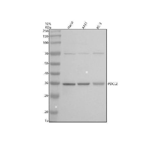 Anti-PDCL2 Antibody Picoband® Boster Bio