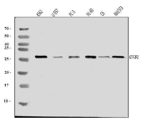 Anti-GTF2F2 Antibody Picoband® Boster Bio