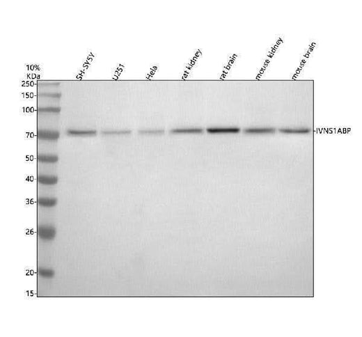 Anti-IVNS1ABP Antibody Picoband® Boster Bio