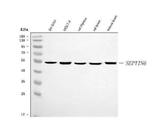 Anti-SEPT6/SEPTIN6 Antibody Picoband® Boster Bio
