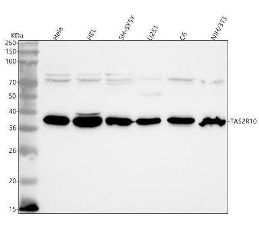 Anti-TAS2R10 Antibody Picoband® Boster Bio