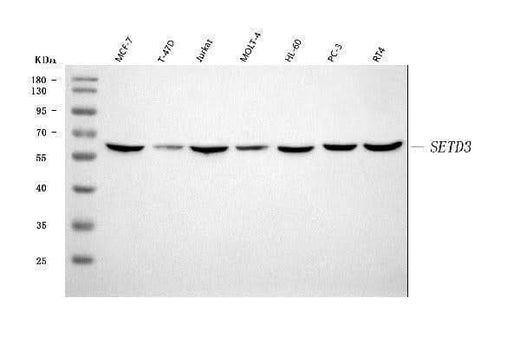 Anti-SETD3 Antibody Picoband® Boster Bio
