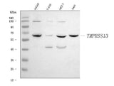 Anti-TMPRSS13 Antibody Picoband® Boster Bio