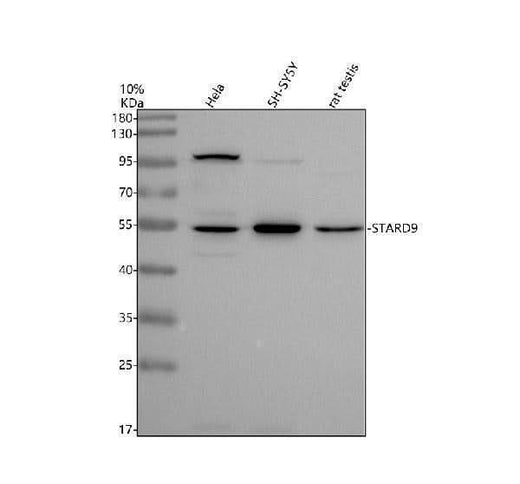Anti-STARD9 Antibody Picoband® Boster Bio