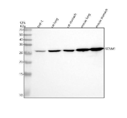 Anti-SCNM1 Antibody Picoband® Boster Bio