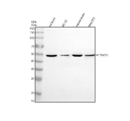 Anti-ATP6V1H Antibody Picoband® Boster Bio