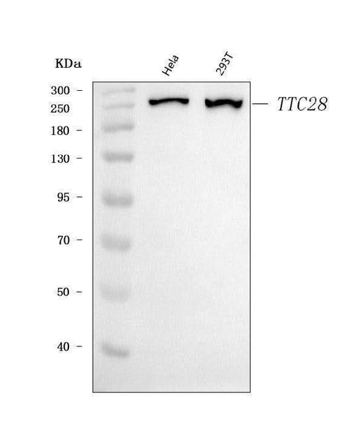 Anti-TPRBK/TTC28 Antibody Picoband® Boster Bio