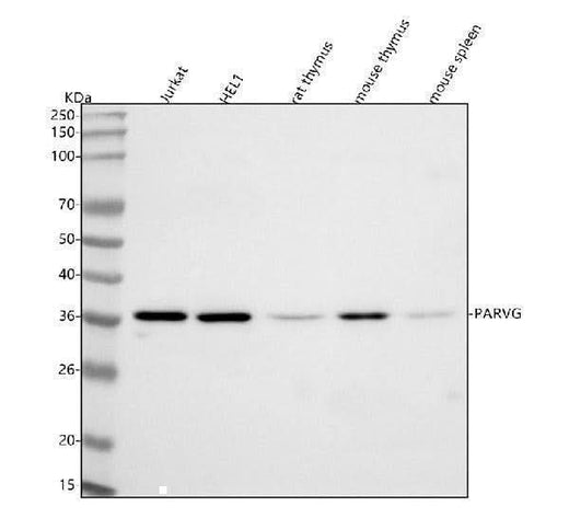 Anti-PARVG Antibody Picoband® Boster Bio