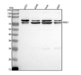 Anti-PPEF1 Antibody Picoband® Boster Bio