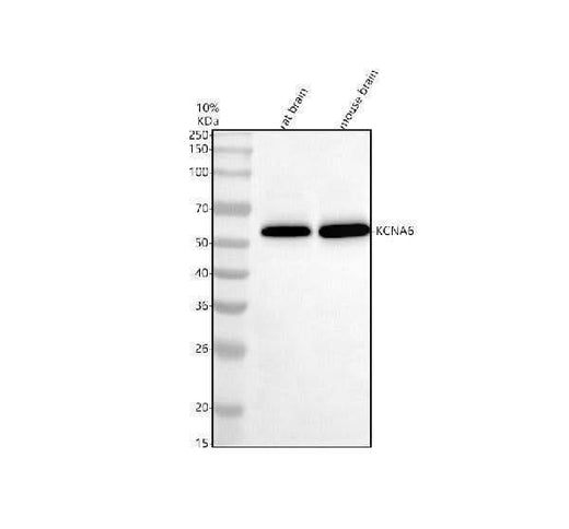 Anti-KCNA6 Antibody Picoband® Boster Bio