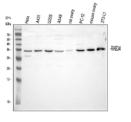 Anti-RAB34 Antibody Picoband® Boster Bio