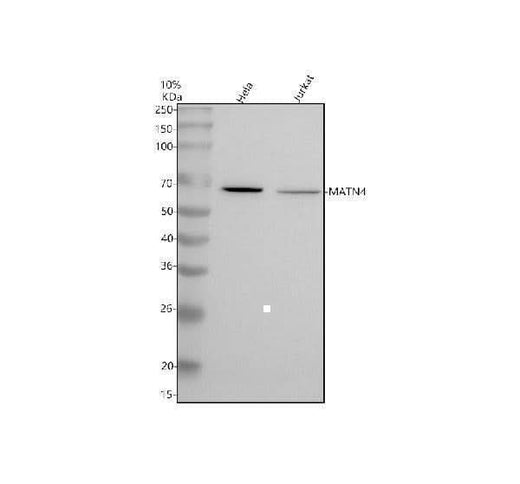 Anti-Matrilin-4/MATN4 Antibody Picoband® Boster Bio