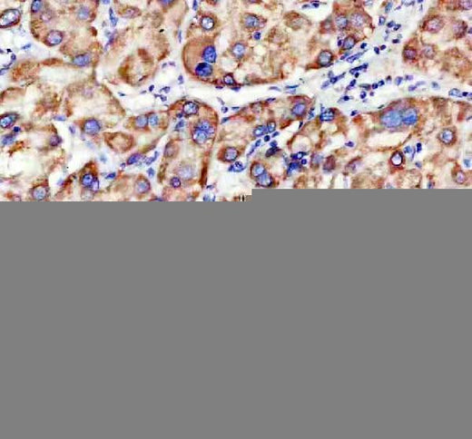 Anti-TIMM9 Antibody Boster Bio