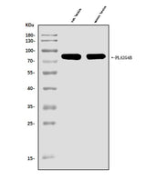 Anti-cPLA2 beta/PLA2G4B Antibody Picoband® Boster Bio
