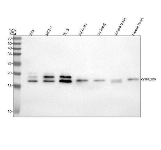 Anti-SYNJ2BP Antibody Picoband® Boster Bio
