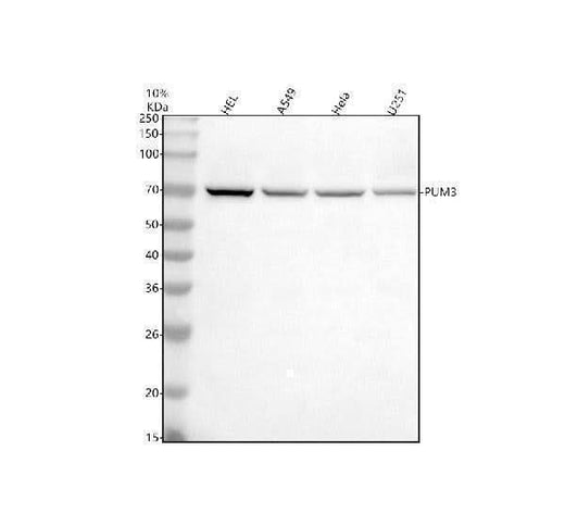 Anti-PUF-A/KIAA0020/PUM3 Antibody Picoband® Boster Bio