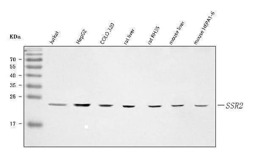 Anti-TRAPB/SSR2 Antibody Picoband® Boster Bio