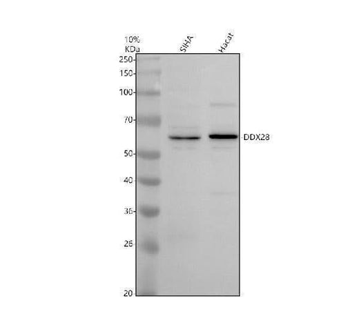 Anti-DDX28 Antibody Picoband® Boster Bio