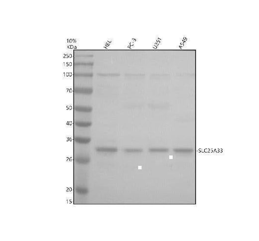 Anti-SLC25A33 Antibody Picoband® Boster Bio