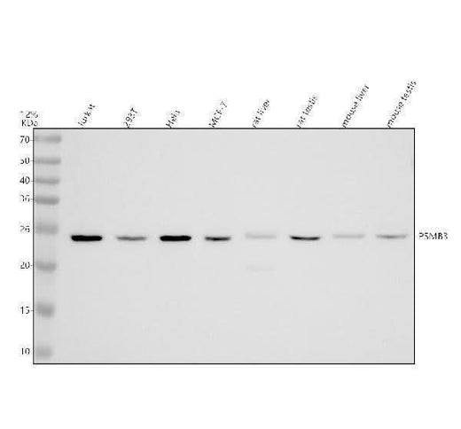 Anti-PSMB3 Antibody Picoband® Boster Bio