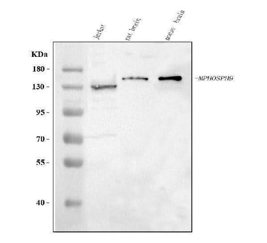 Anti-MPHOSPH9 Antibody Picoband® Boster Bio