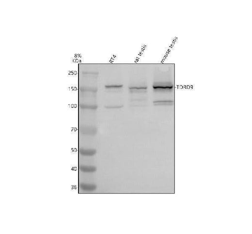 Anti-TDRD9 Antibody Picoband® Boster Bio
